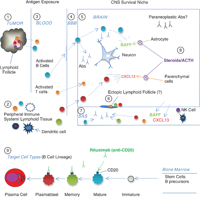 Schema of possible immunopathogenesis in paraneoplastic opsoclonus-myoclonus syndrome